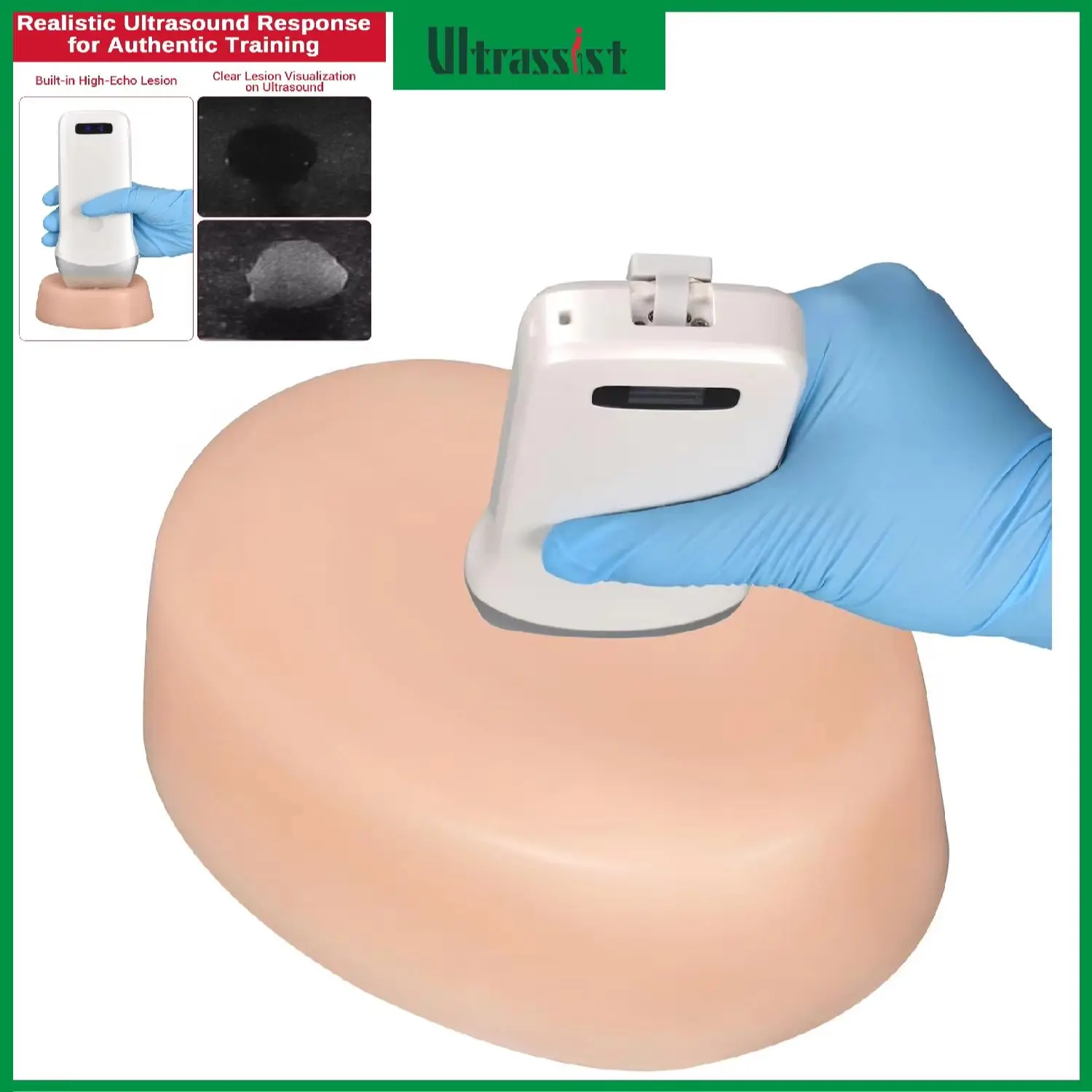 Ultrassist Puncture Silicone Model Ultrasound-guided Simulated High/Low Echo Mass Needle Location for Medical Student Residents