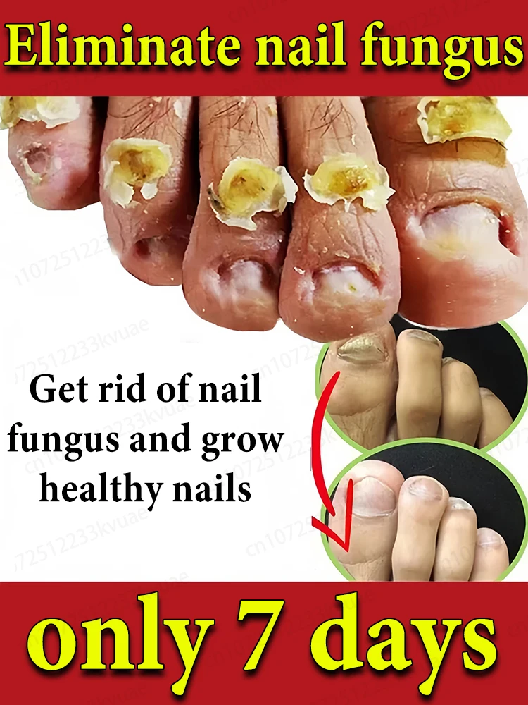 

Hʏᴅʀᴀᴛᴇᴅ ᴛᴏᴇs ᴇxᴜᴅᴇ ᴀ ʜᴇᴀʟᴛʜʏ sᴄᴇɴᴛ