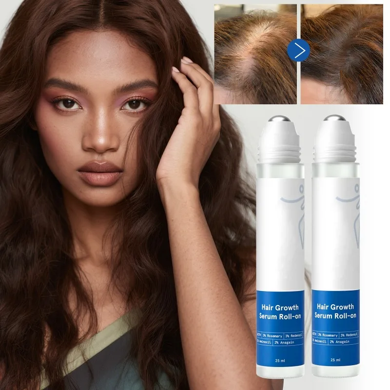 

25 мл натуральное эссенция для роста волос с розмарином, масло для восстановления поврежденной кожи головы, питание для ухода за волосами, увлажняющее, укрепляющее средство для ухода за волосами