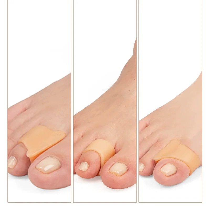 1/2/3/4Pairs Hammer Toe Straightener Hammertoe Finger Corrector for Curled Crooked Bent and Claw Toes Lift Toe Tip Toe Cushion 3