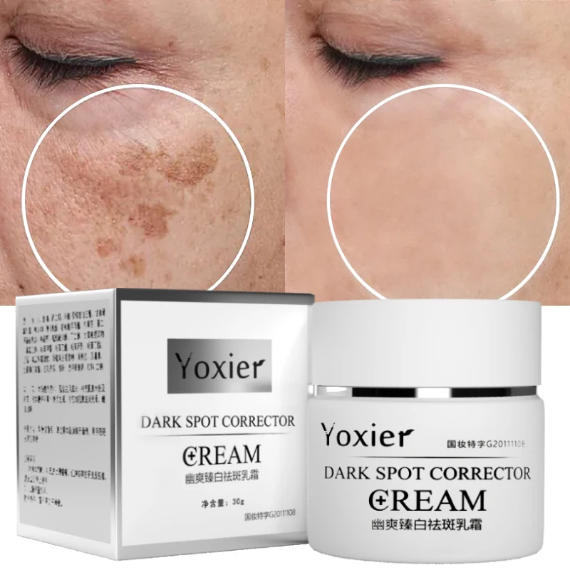 

Moisturizing Whitening Freckles Cream Remove Melasma Dark Spot Acne Marks Lightening Melanin Brightens Skin Tone Face Skin Care