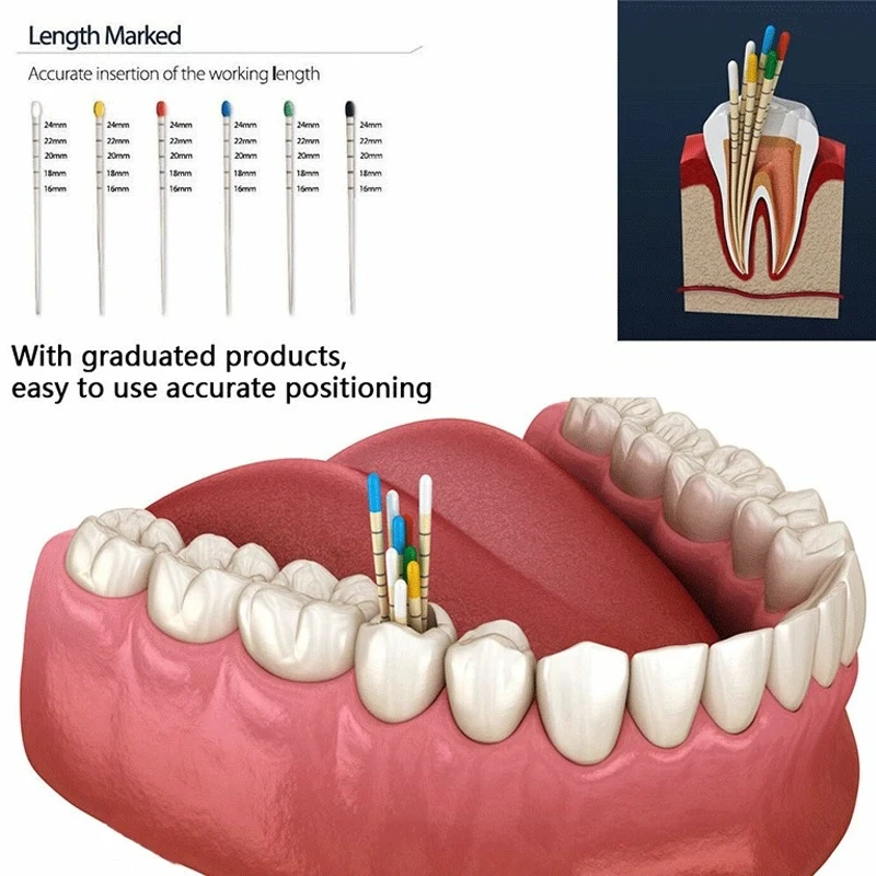 

10boxes Dental Gutta taper 02 04 06 15#-40# F1 F2 F3 With scale Endodontics Absorbent Paper Dentistry Materials Consumable