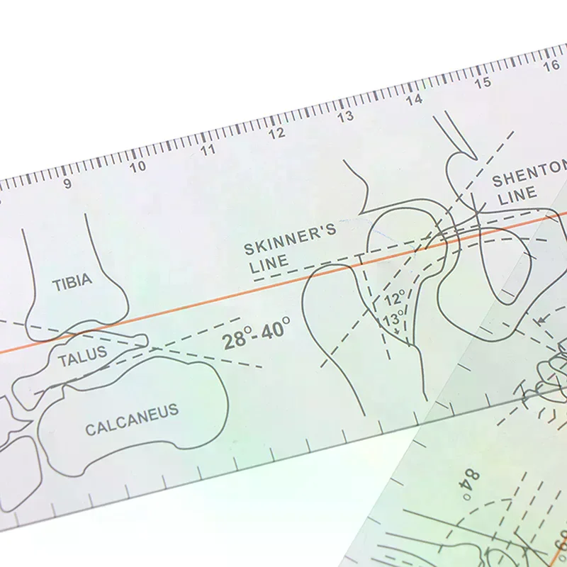 Alat Ukur Sudut Multi-Ruler Goniometer Medis untuk Ortopedi Sendi