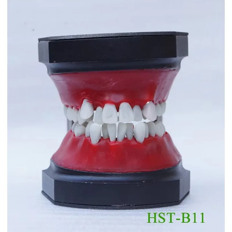 YTYIN نموذج تدريب محاكاة تقويم الأسنان مكون من نموذج أسنان مزخرف بالشمع وإطار فكي لتقويم الأسنان #5