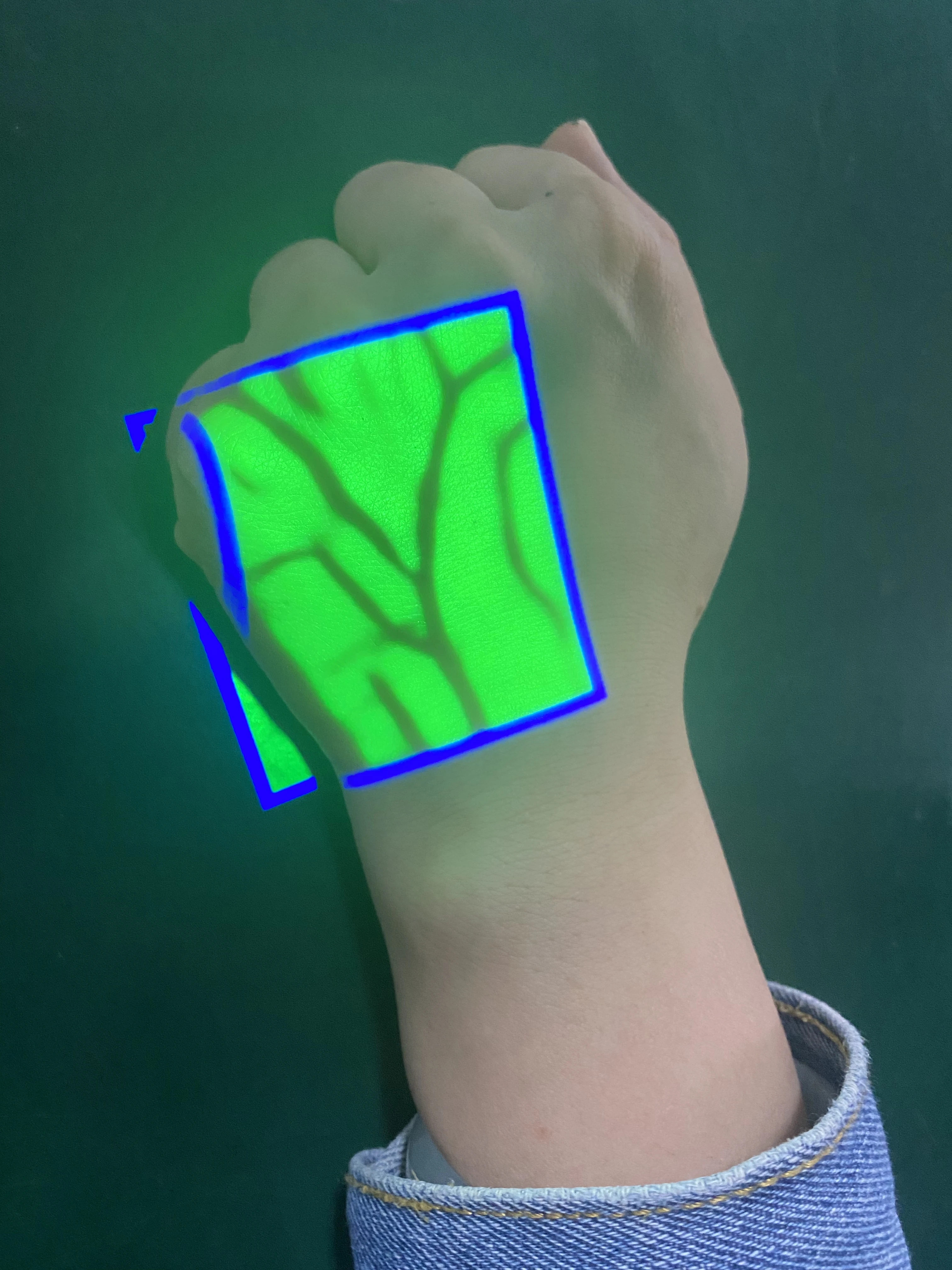 thumb