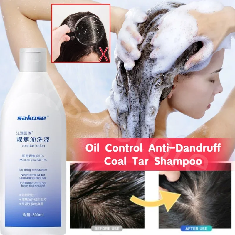 

300ML Coal Tar Shampoo Gently Cleanses Scalp Refreshing Oil Control Anti-Dandruff Itching Smooth Nourishing Shampoo