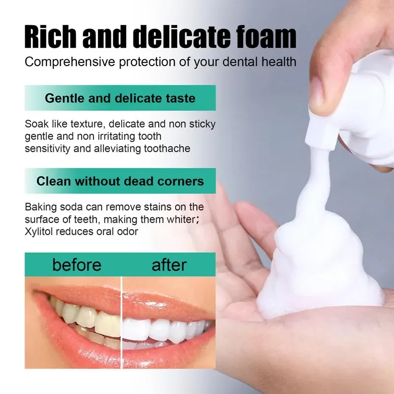 Blanqueador Dental para limpieza de Mousse, reparación de Caries, esencia para el cuidado Dental, refresca la respiración, elimina las manchas de