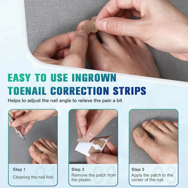 Nail Correction Stickers Ingrown Toenail Corrector Patches Paronychia Treatment Recover Corrector Pedicure Tools