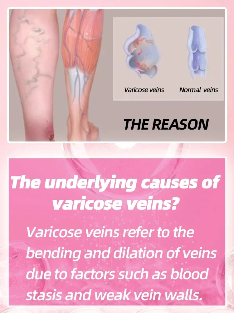 Best Selling Varicose Vein Laser