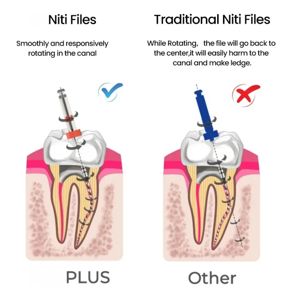 JINGT PLUS 5 Boxes Heat-Activated NiTi Rotary Files Premium Anti-Broken High Toughness Endodontic Tools for Dental Doctors