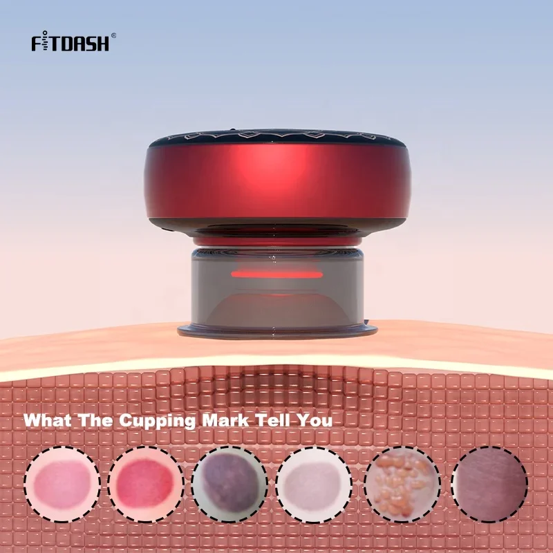 Fitdash Cupping Massager Vacuum Suction Cup Light Therapy Medical with 650 nm Red Light Therapy
