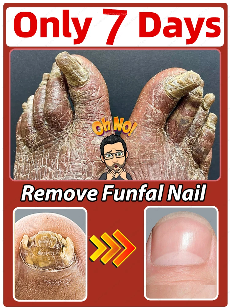 

Solving the nail problem