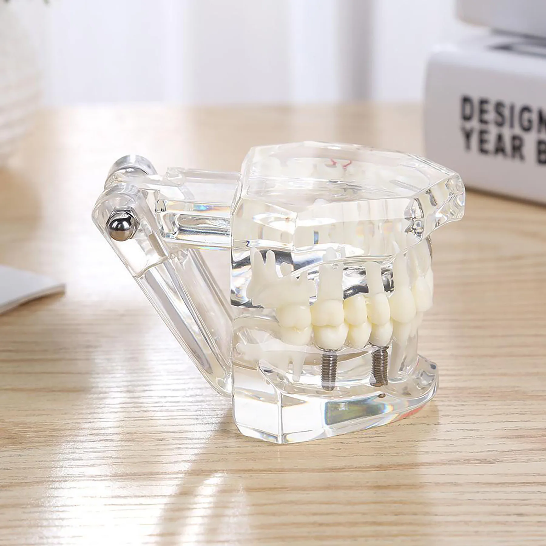 

Dental Model Implant Teeth Resins Model With Restoration Bridge Teaching Model For Patient Education Demo Dentistry Products