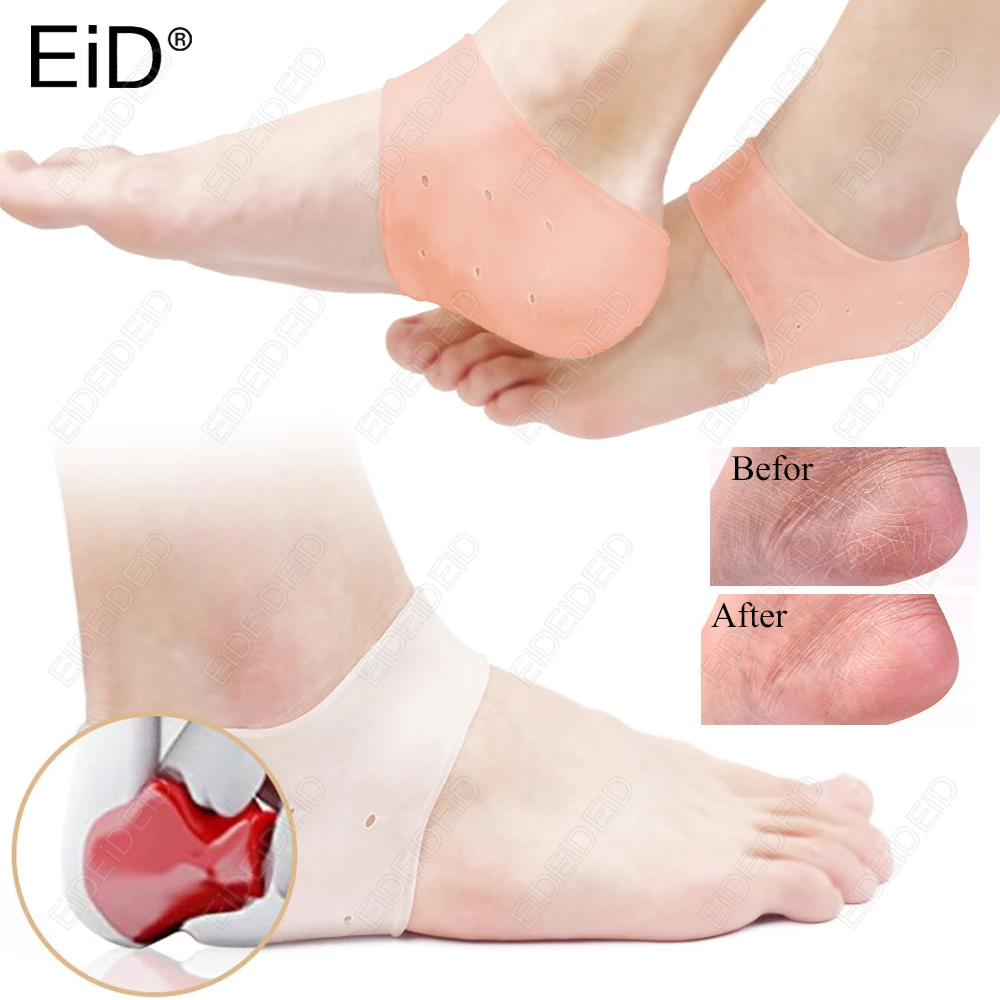 1/2 Paar Silikon-Gel-Fersenbecher, Plantarfasziitis, Fersensporn, Linderung von Schmerzen, Druckreduzierung, rissige Fersenpflege, Einlegesohle für Männer und Frauen
