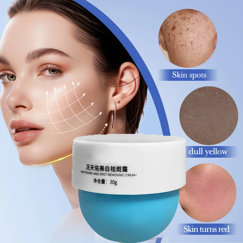 Отбеливающий крем от веснушек, удаление темных пятен, крем против веснушек, крем для лица, ниацинамид, выцветание пигментации, мелазма, осветляющий уход за кожей, 30 г