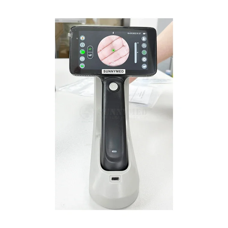 SY-V042A tragbare ophthalmo logie handheld fundus retina preis