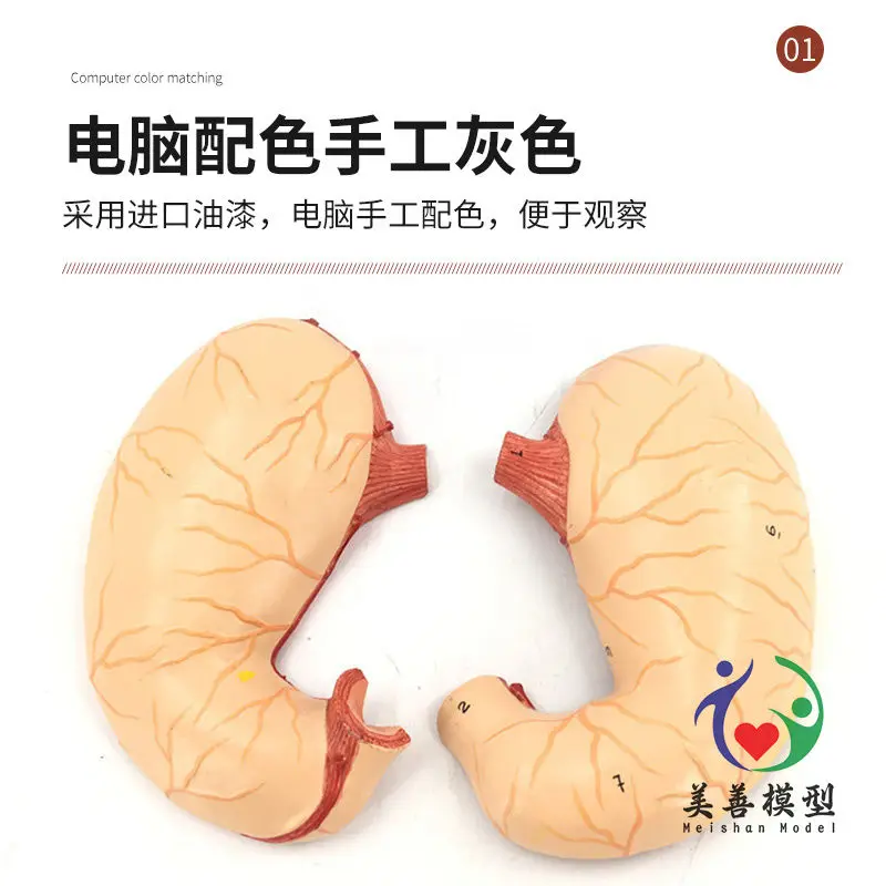 Simulated Human Stomach Anatomy Model, Enlarged Stomach Anatomy Model, Natural Large Stomach And Section Model, Teaching