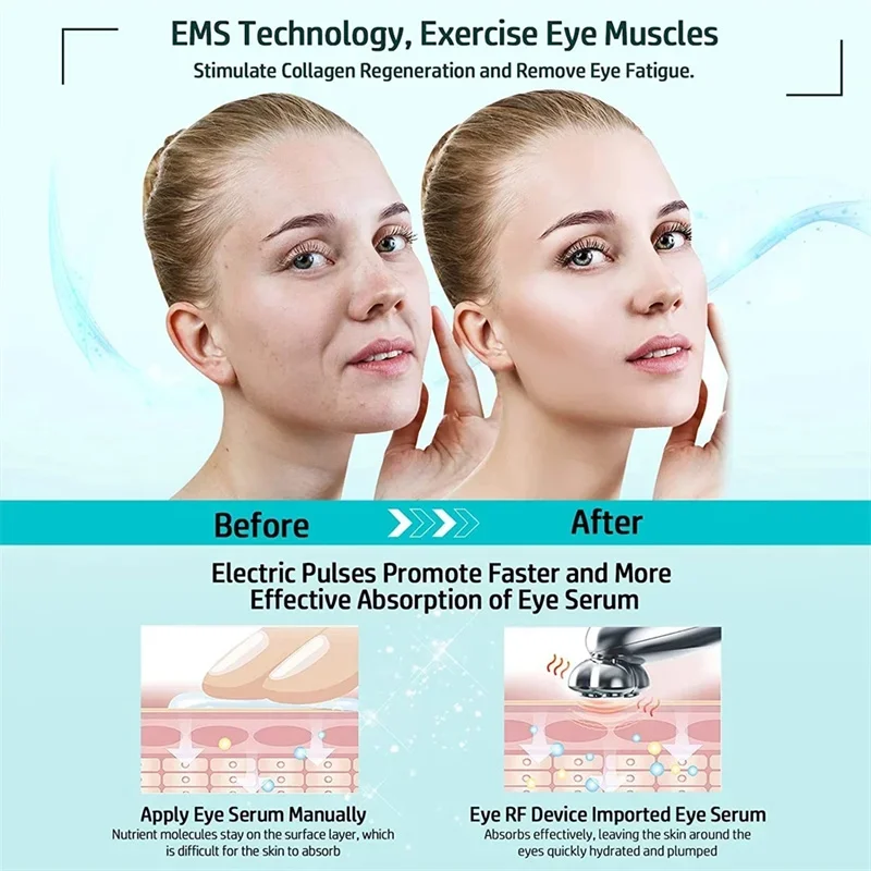 RF Electric Eye Massager facial lift anti-aging wrinkle skin rejuvenation Compact Skin Care Relax Eye Massager