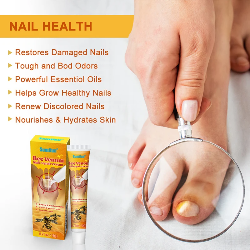 20g Krim Perawatan Kuku Krim Perawatan Kuku Racun Lebah Salep Ulser Tekanan Racun Lebah
