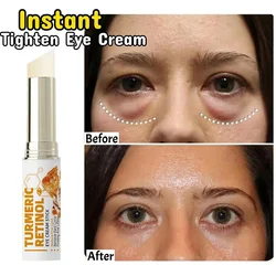 Instantâneo círculos escuros Puffiness Eye Cream, Anti partículas gordas, círculos escuros, desvanecer-se linhas finas, levantar, iluminar, beleza coreana, cuidados com os olhos