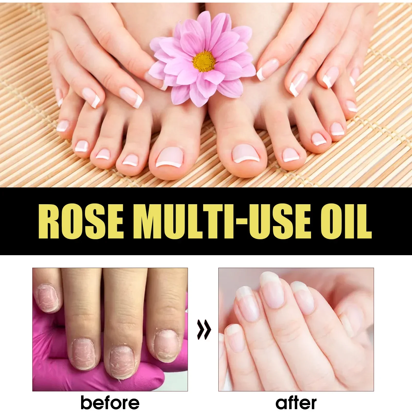 Eelhoe Rose Pets Essential Oil Skin Skin Hair Care Foot Anti-Chapping Multi-Effect Care Oil Intensive Repair Damaged Skin