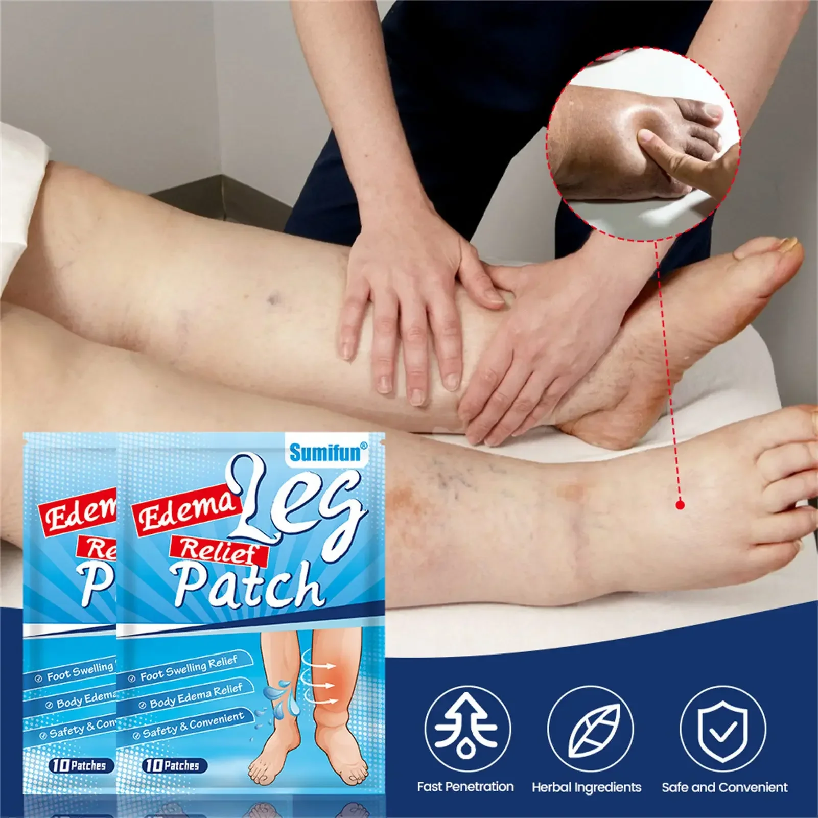 Perna Pain Relief Patch para os Pés, Remendos Médicos de Edema, Vasculite Flebite Spiderleg, Tratamento Inchaço, Adesivo de Cuidados de Saúde, 30PCs