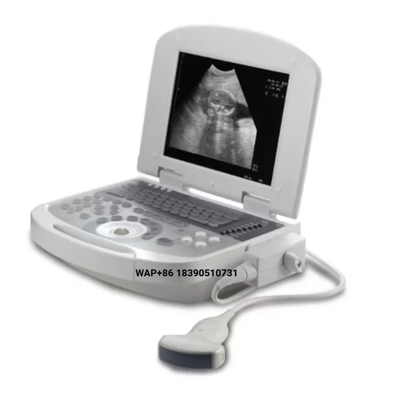 Jinzhong JZ-SW2200 Portable All-Digital Veterinary Ultrasound Diagnostic System CE Certification Level II High Resolution Imagin