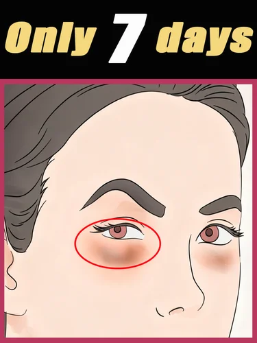 Pasta de generación-2 dice adiós al su problema en 7 días