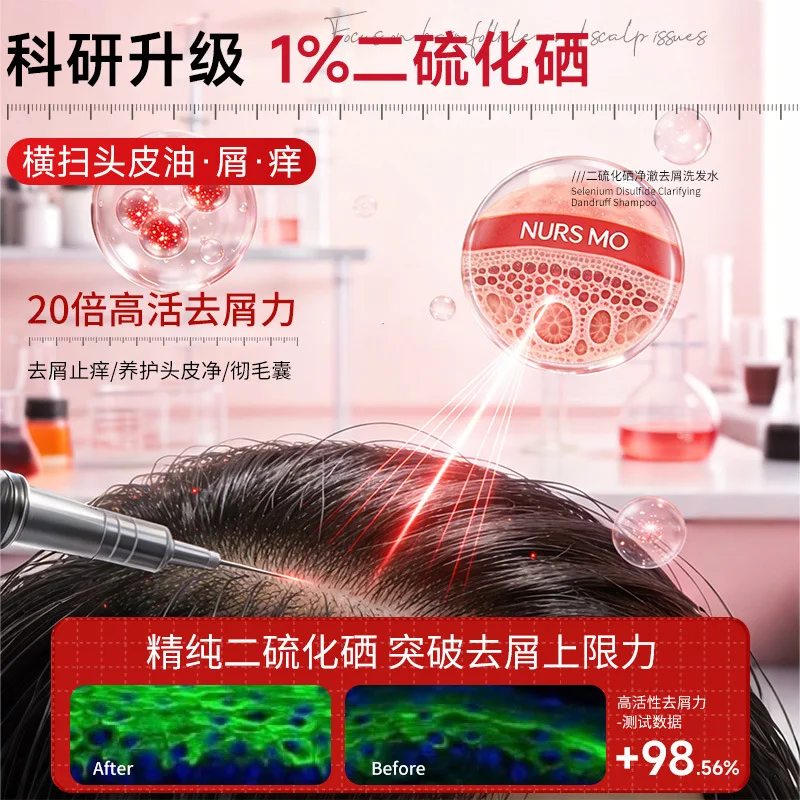 1% Selenium Disulfide Shampoo Oil Control Fluffy Anti-Dandruff Anti-itching Mite Removal Hair Follicle Shampoo for Men and Women