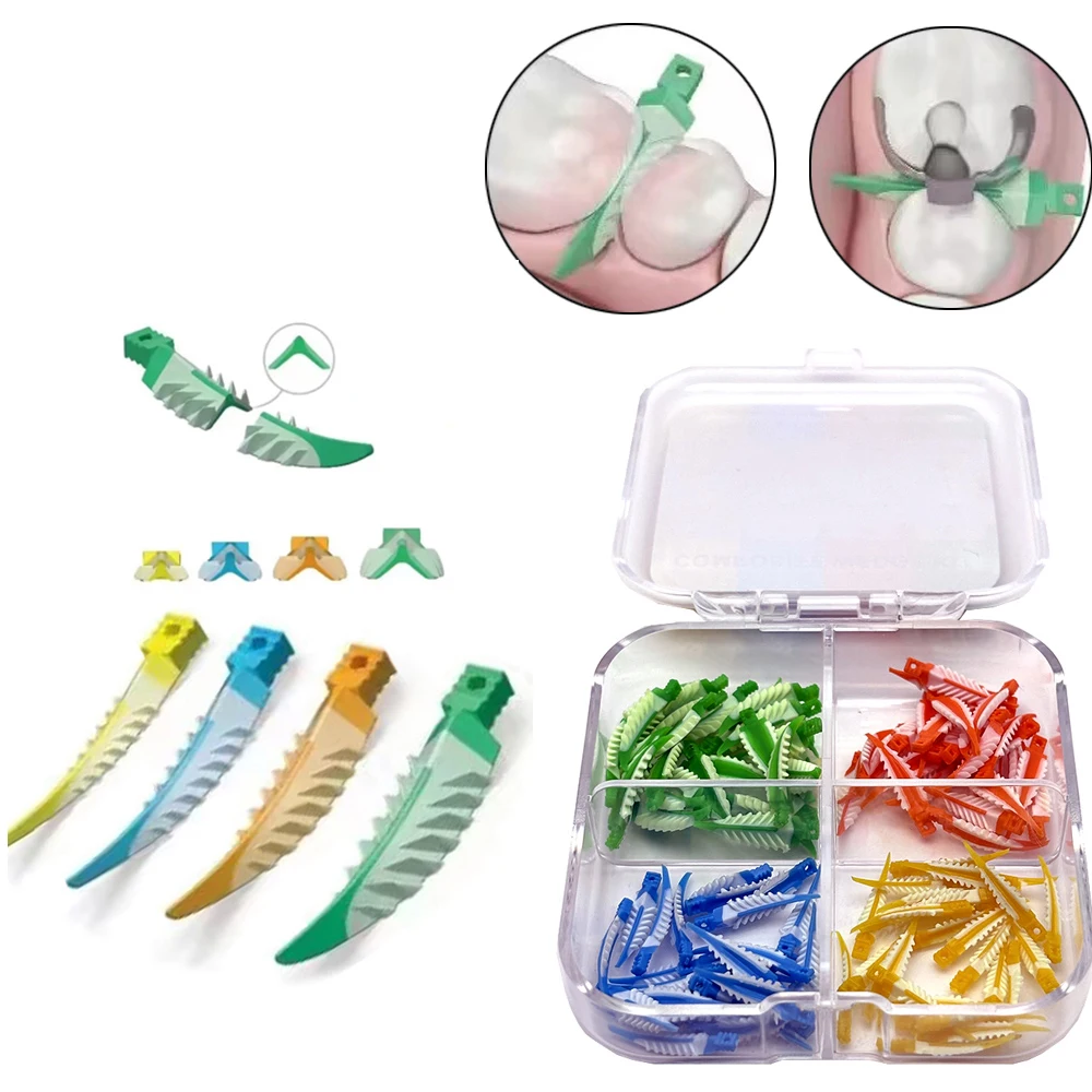 

100Pcs Dental Interdental Wedges Kit Autoclaved Silicone Matrix Composite Wedges for Dentist Restorative Adaptive Tools