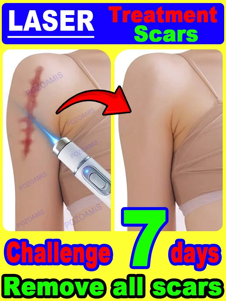 

Suitable for all kinds of scars