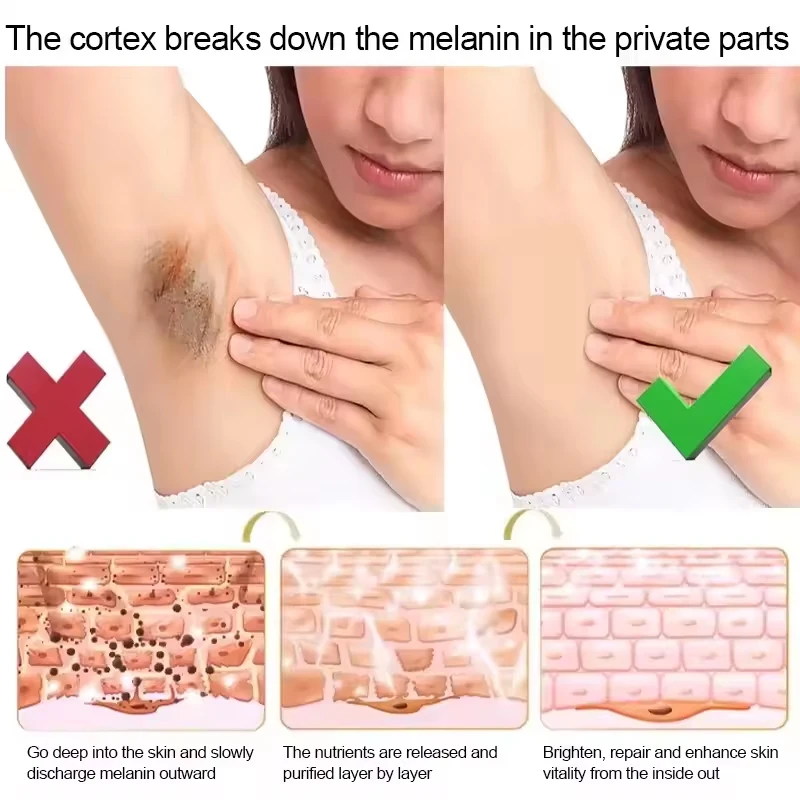 Body Snow Bleach Cream Nicotinamide Brighten Private Parts Underarm Bleaching Armpit Elbow Knees Joint Removal Dark Spot Melanin