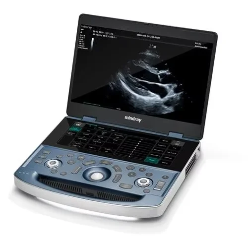 Mindray ME7 MX7 Color Doppler Ultrasound Hand-Carried Ultrasonic Diagnostic Imaging System