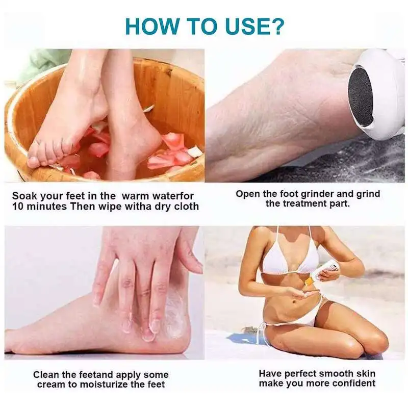Gran oferta, molinillo de pies USB eléctrico portátil, Lima para pies, eliminador de callos de piel muerta para piel seca, agrietada y dura muerta