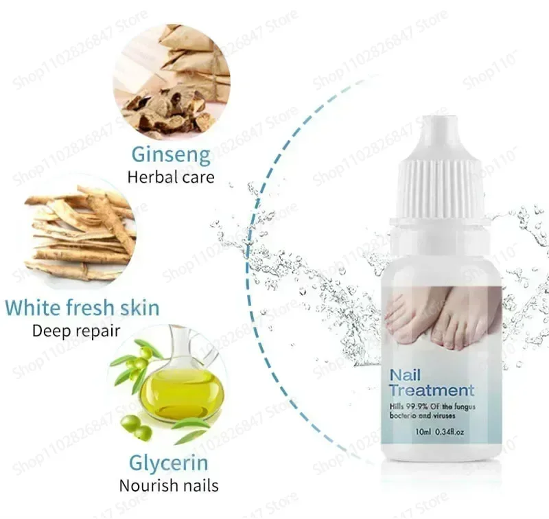 Anti-Infection Cream Fungus Nail Removal Fungus Foot Repair Serum