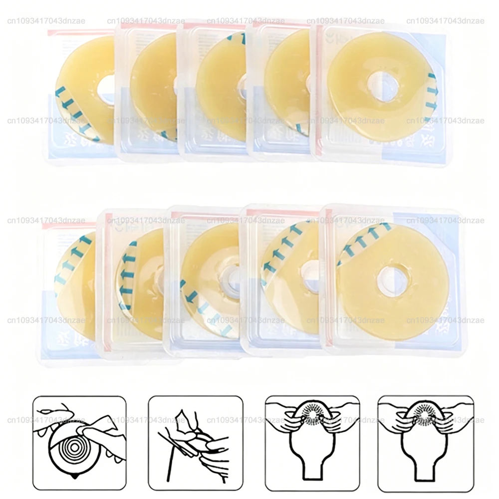 

10Pcs/set Colostomy Bags Anti-leak Ring Portable For Stoma Bags Supplies Protective Barrier Rings Ostomy Bag Assistance