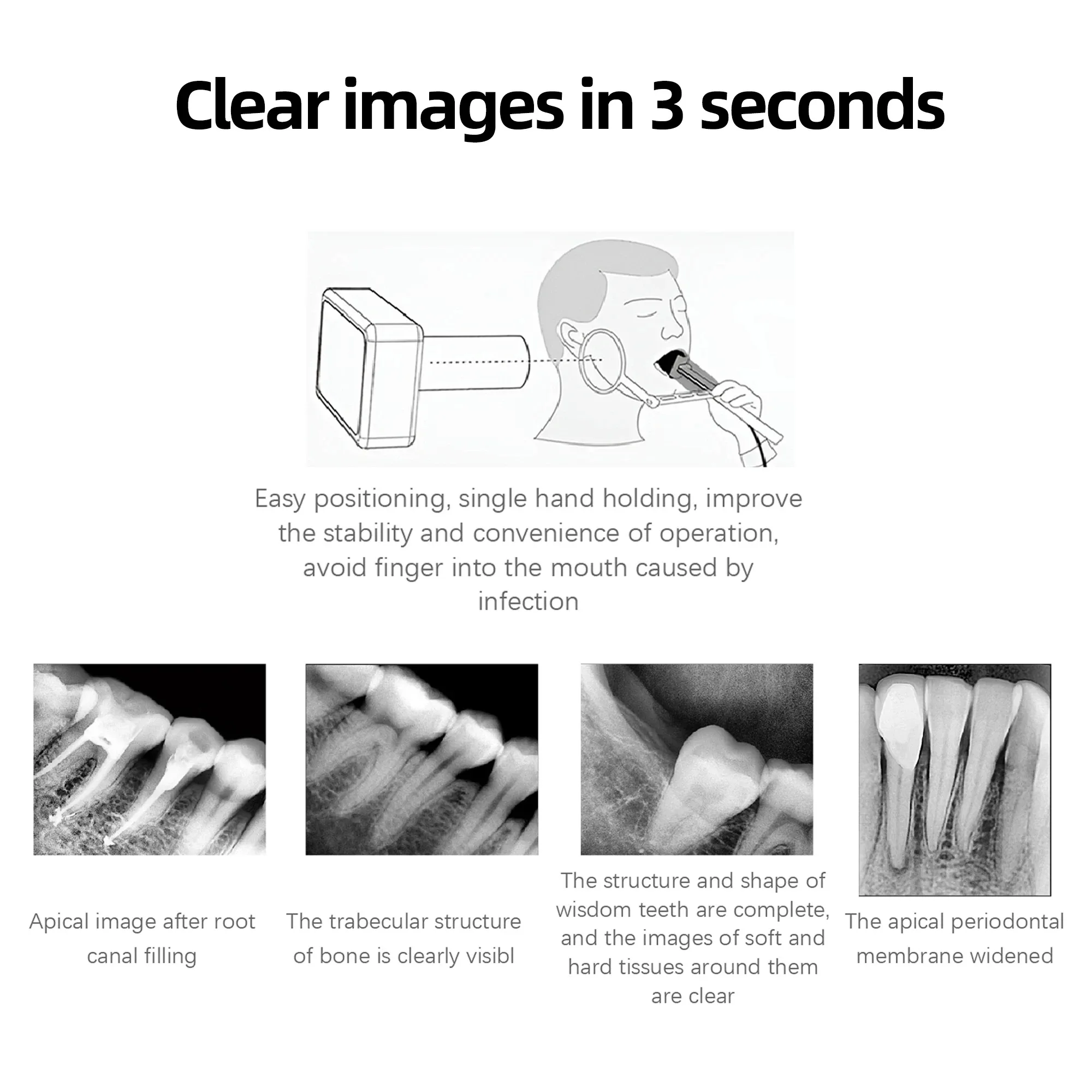 Professioneller Dental-Röntgensensor - Radiovisiograph-Bildgebungssystem - Hochfrequenz-Intraorale Filmarbeit & Kamera-Zahnmedizinische Ausrüstung – Detail 9