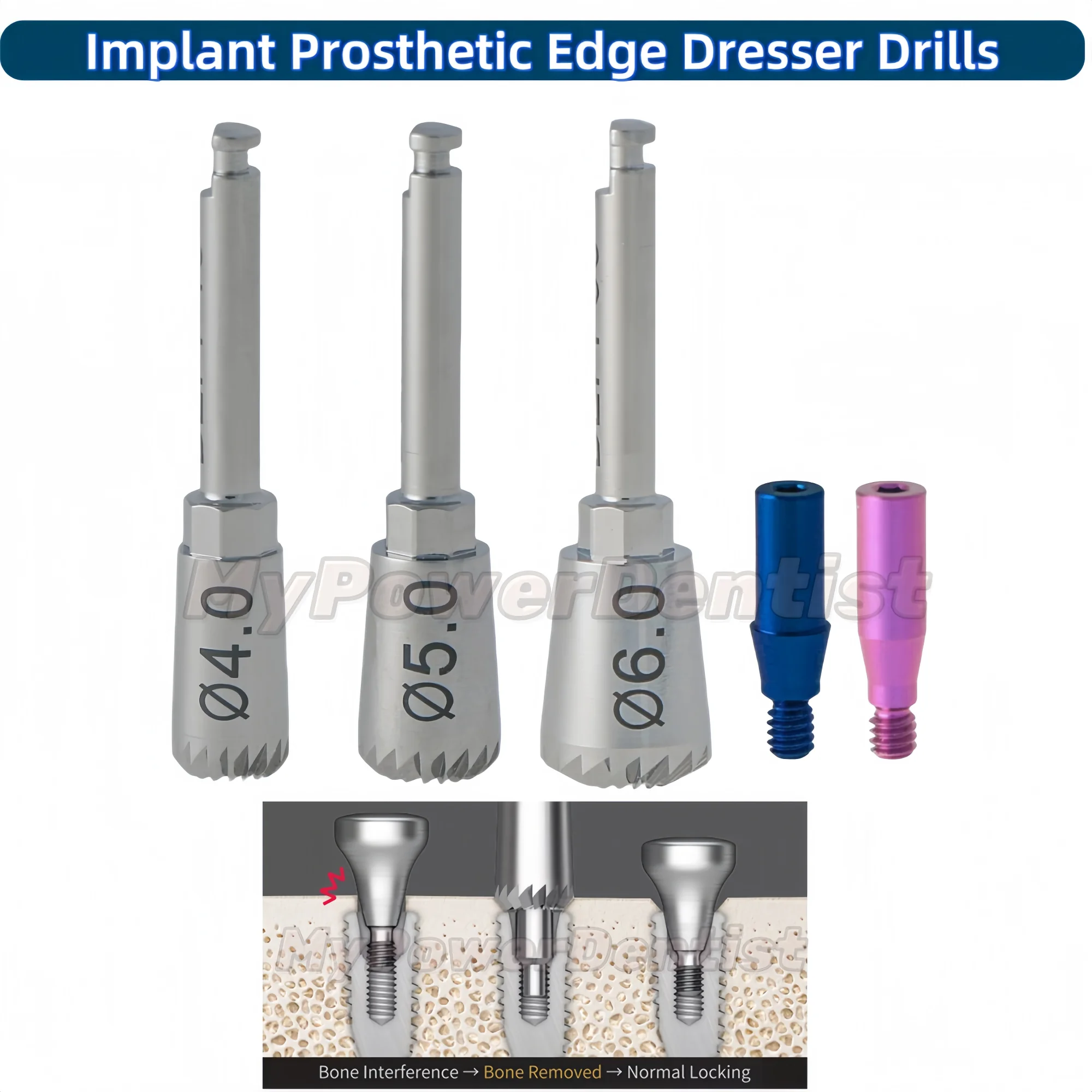 Dental Implant Prosthetic Kit Torque Driver Multi ABT Bone Profiler M6019 4.0/5.0/6.0 Drill