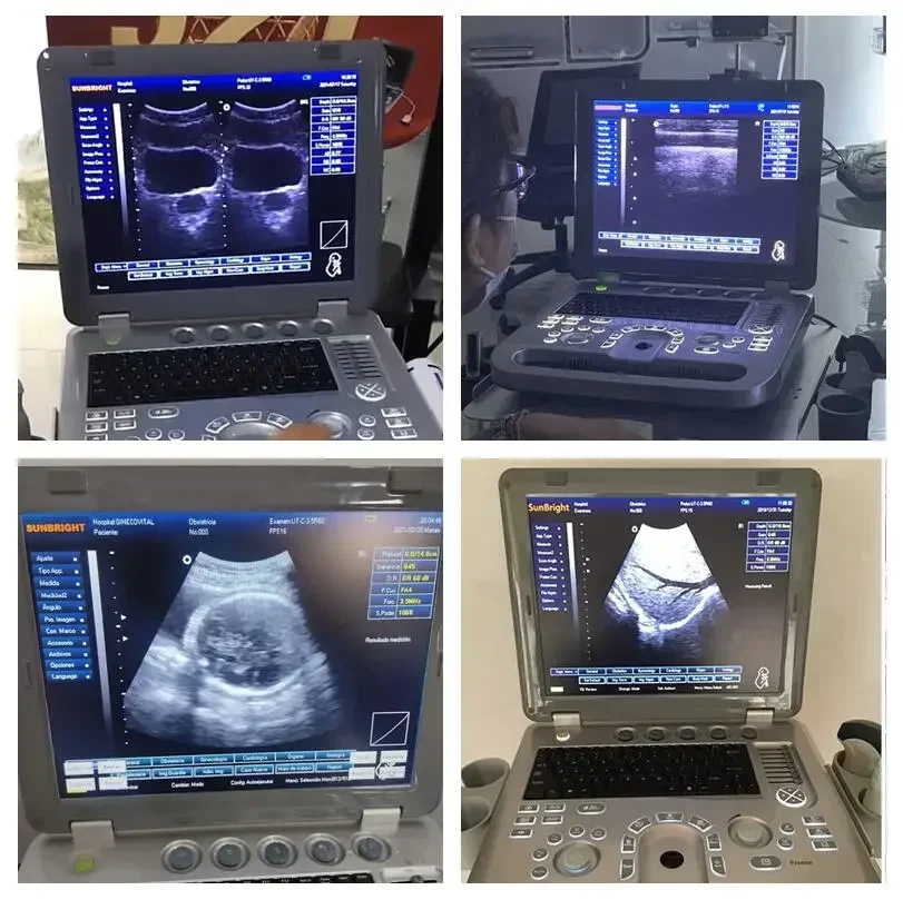 Latest design sunbright SUN-800D ultrasound machine veterinary portable ultrasound price