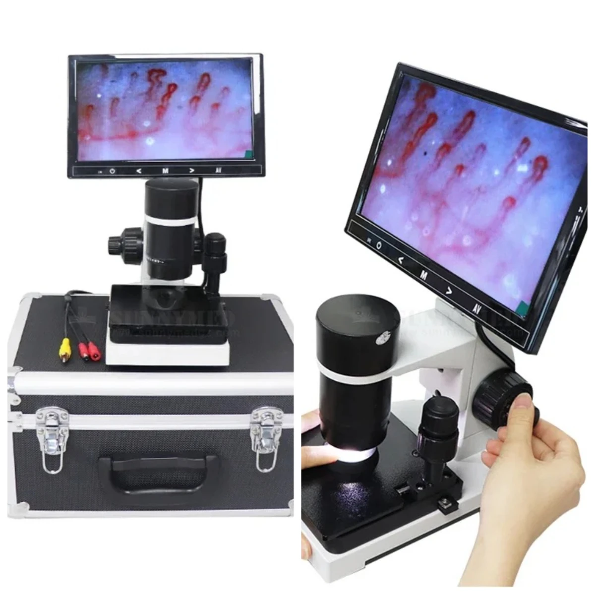 【Hot Selling】SY-B198 Capillary Microscope With 9 Inch LCD Screen Nail Fold Capillaroscope