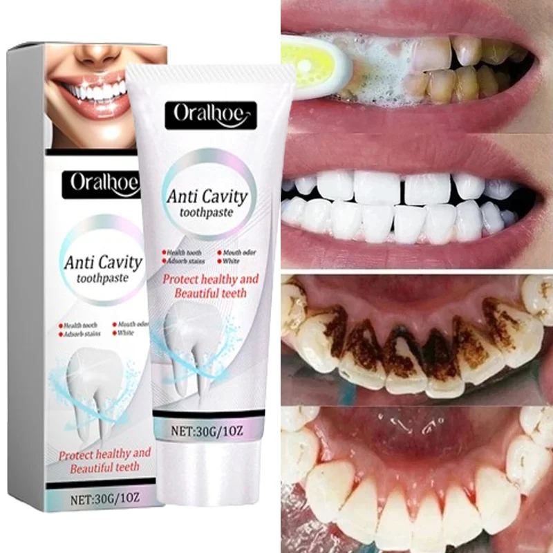 

Prevent Repair Tooth Decay Remove Plaque Relieve Periodontitis Toothache Freshen Bad Breath Deep Clean Tartar Stain Toothpaste