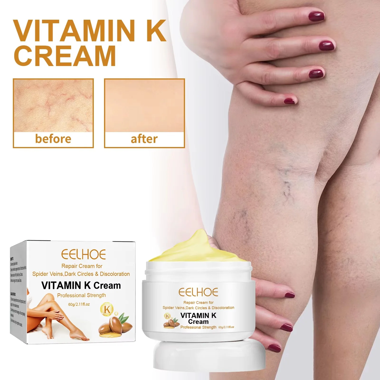 EELHOE Vitamin-K-Creme für Beine – kühlende Krampfadern-Pflege, beruhigende Linderung, Schwellungen, Muskelschmerzen, Massage, feuchtigkeitsspendende Hautpflege