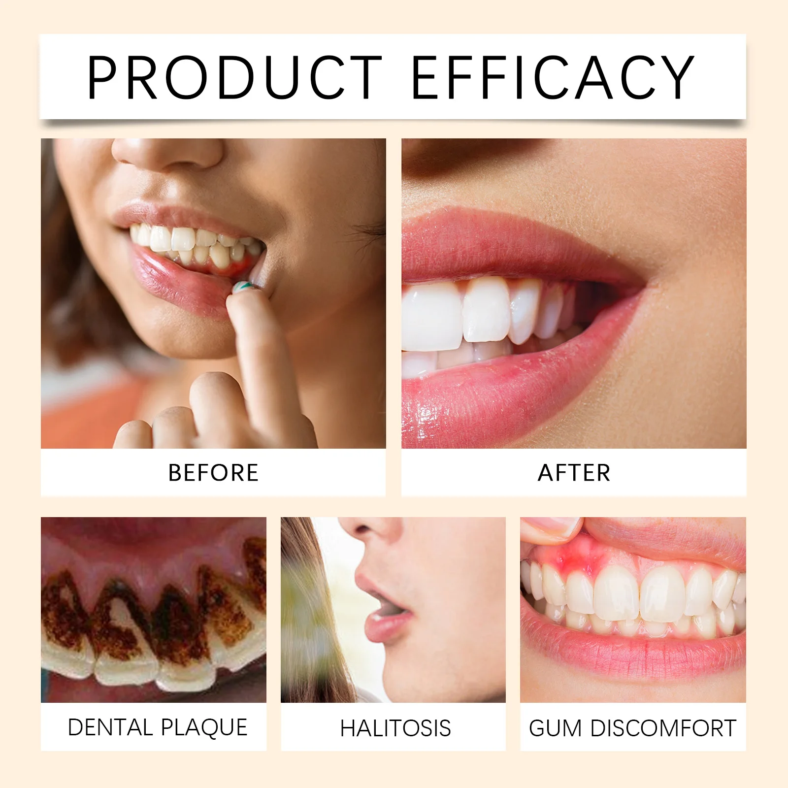 VB1 قطرات إصلاح اللثة بالنعناع تخفيف إعادة التورم اللثة تنظيف العناية بصحة الفم اللثة إزالة مزيل الأصفر