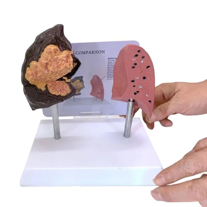 نموذج تباين الرئة القابل للنقل المدخن مقابل المعدات التعليمية السريرية الصحية PVC D5QC