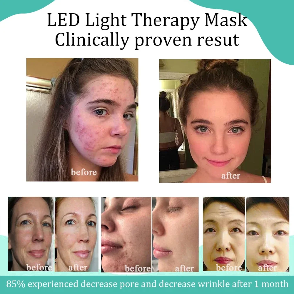 Beauty 2024 led mask firming facial device mascara facial led con luz de fotones oem pdt photon infrared light facial neck mask