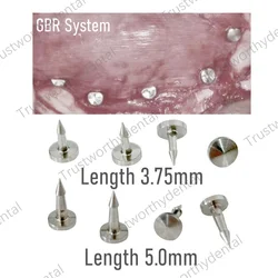 Dental GBR Tacks Membrane Auto Gun Pins Nails Membrane Guided Bone Regeneration Titanium 3.75mm 5mm Short Long