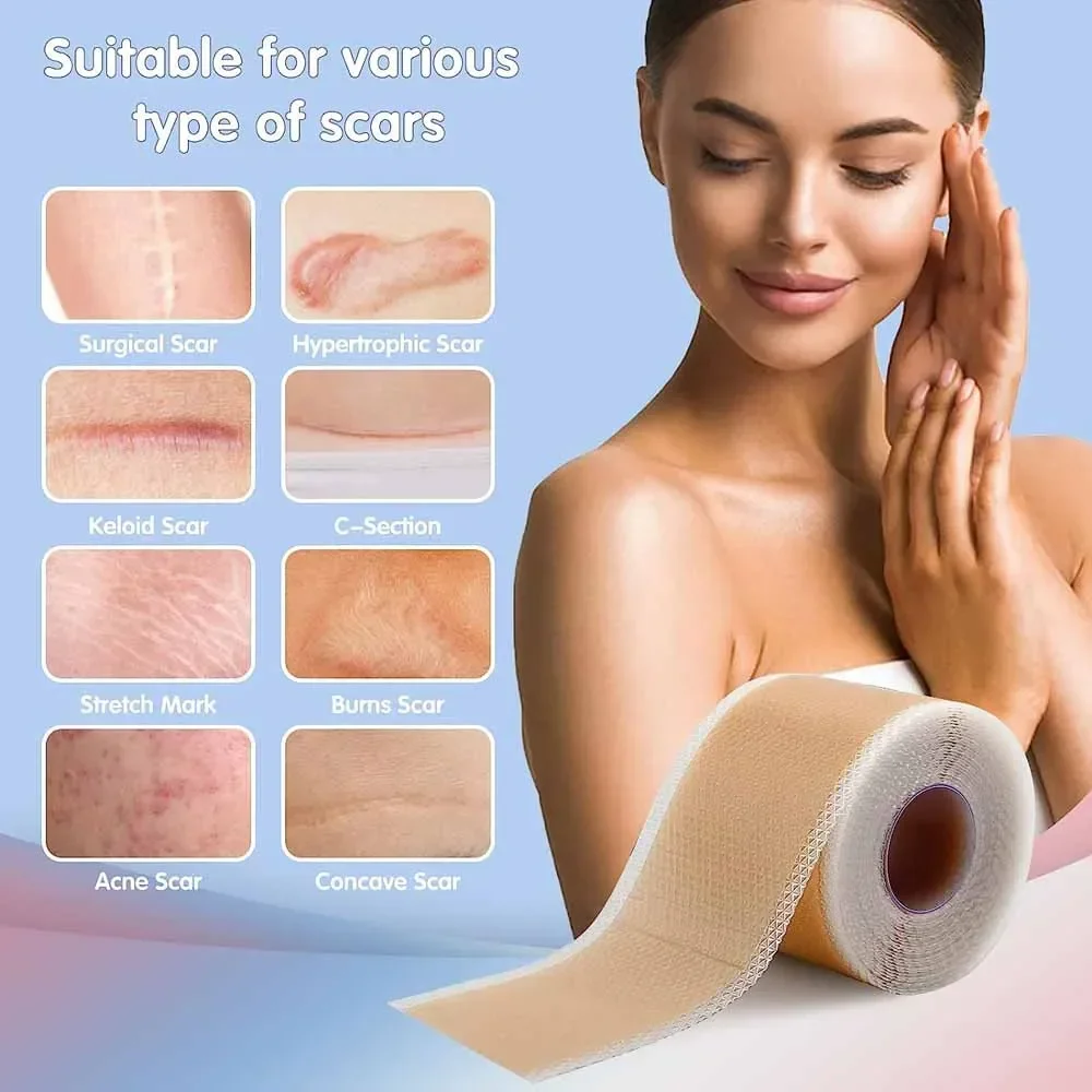 1 Roll Silicone Scars Sheets Keloid Bump Removal Strips,Scars Reducing Treatments Surgical Scars,Burn,Tummy Tucks,Acne,C-Section