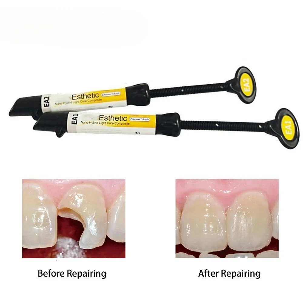 4g/シリンジ DENTEX エナメル樹脂 - 前歯修復用光重合型コンポジット、ナノハイブリッド充填材（A2/A3）