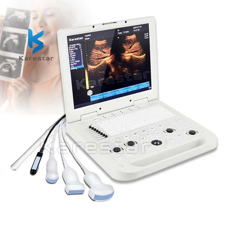 

ultrasonic Instruments Portable Color Doppler 3D 15 inches portable ultrasound machine