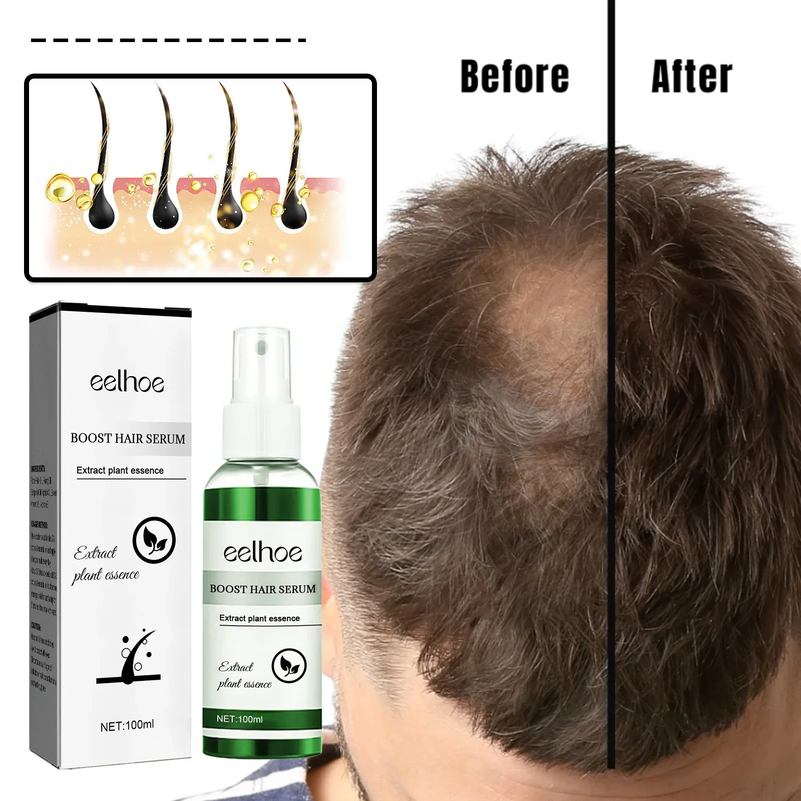 Eelhoe Rosemary Herbal Hair Care Essence Anti-Drop Solid Hair Strong Hairs Supple Hairs Care Dense Hairs Liquid Hair Growth